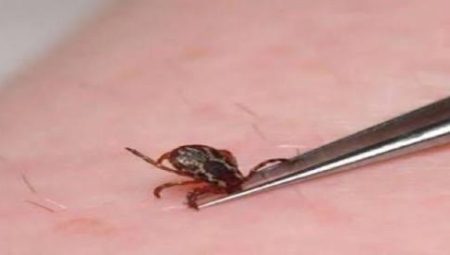 Vücudunuza kene yapışmışsa zarar vermeyin!